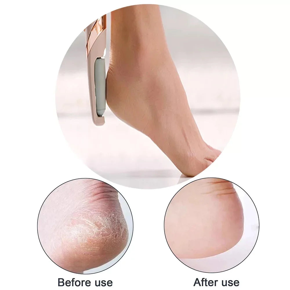 Electric Foot Callus Remover